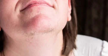 Chin hair 1600x900