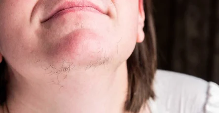 Chin hair 1600x900