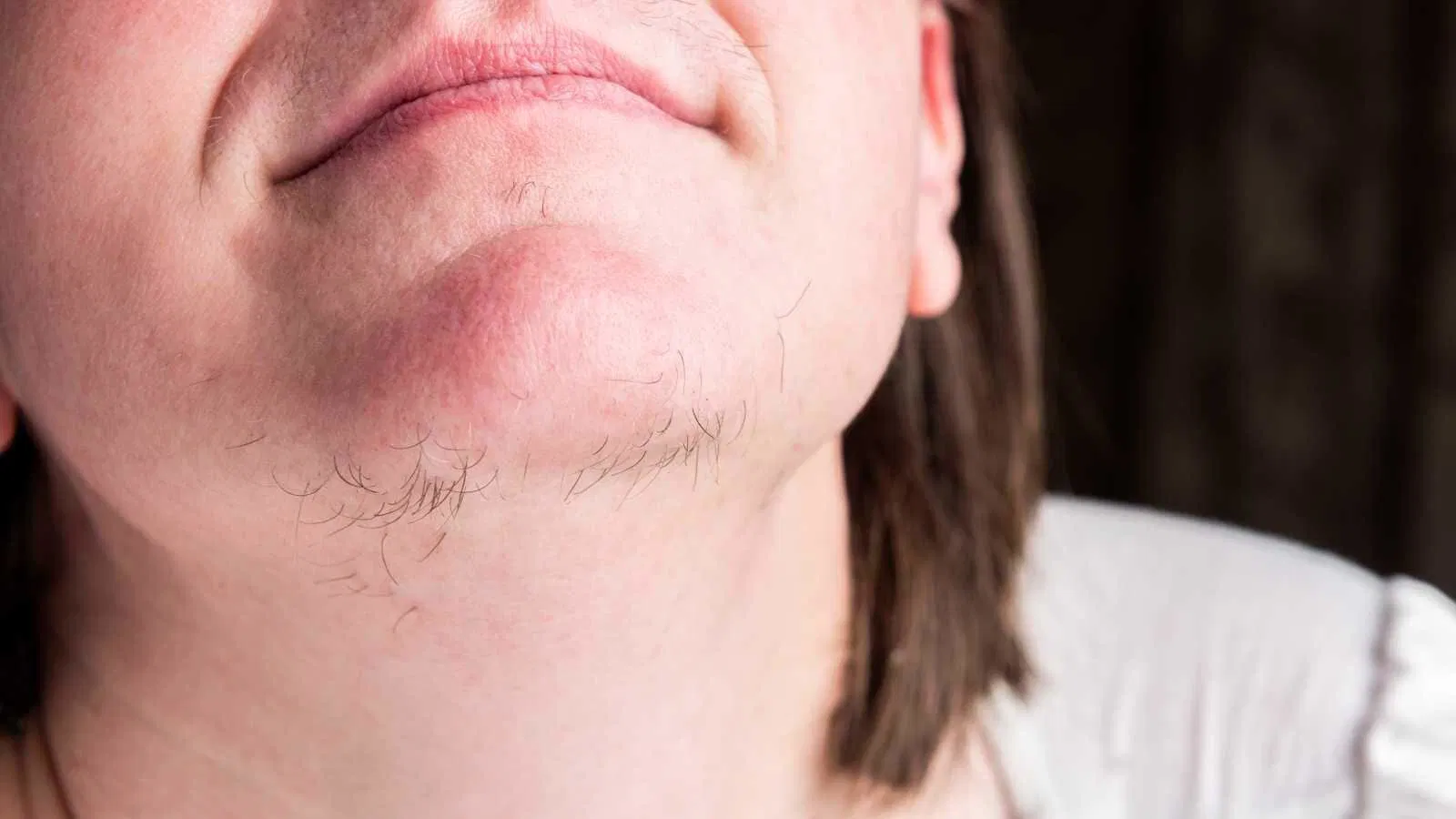 Chin hair 1600x900